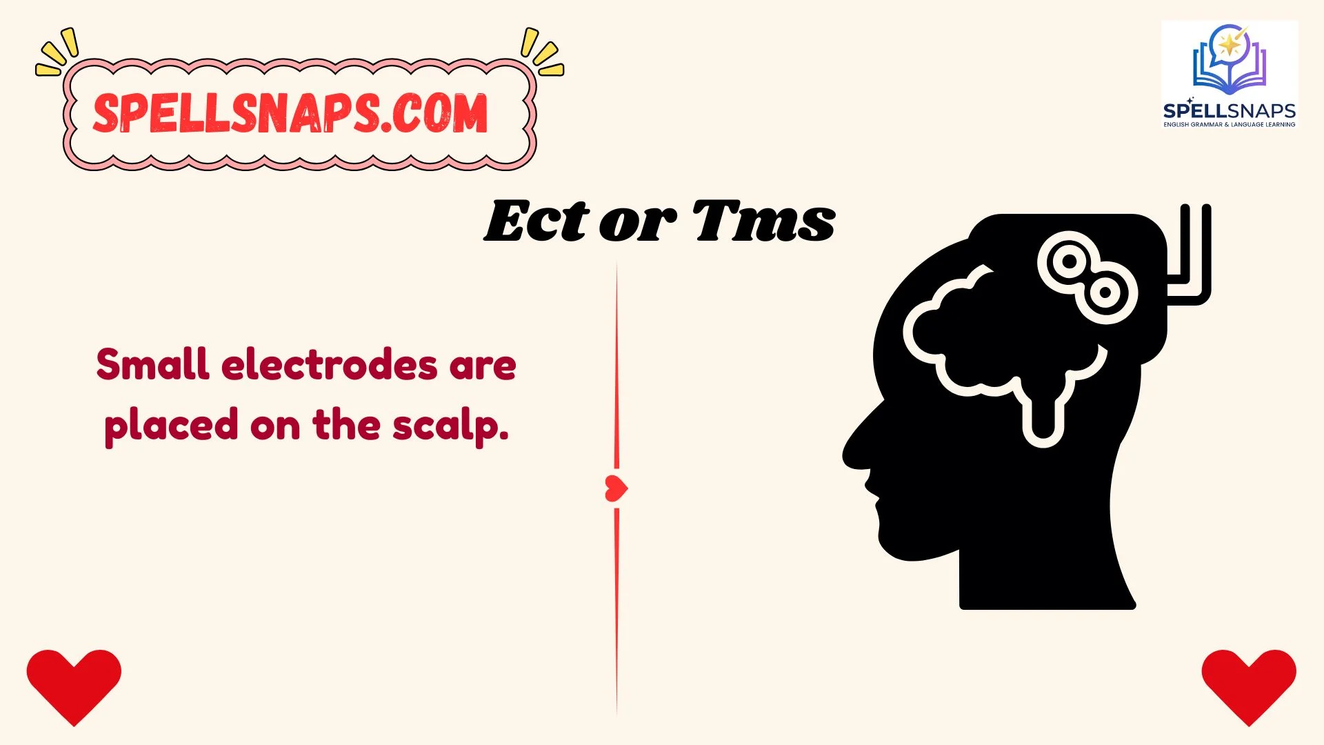 ect or tms