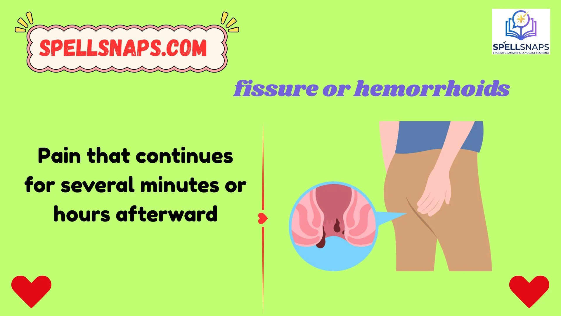 Fissure or Hemorrhoids