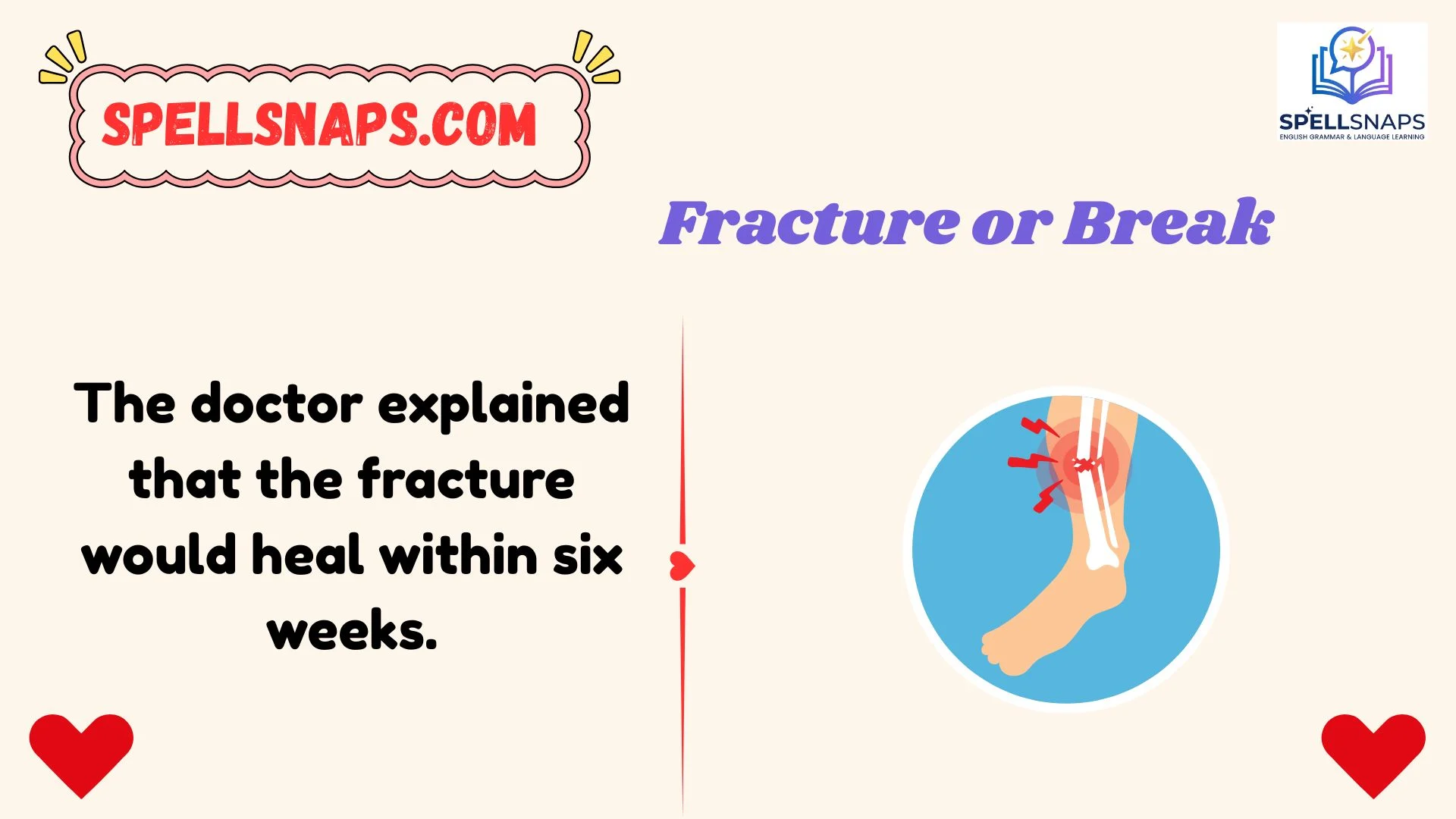 Fracture or Break