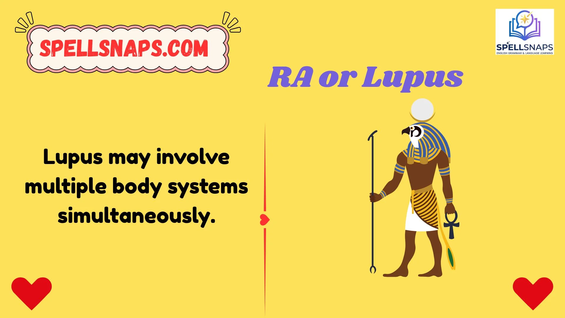 RA or Lupus